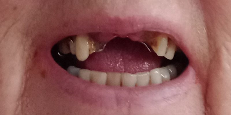 Bupa Dental Care Danbury