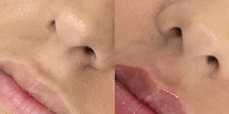 Castle Aesthetics Colchester