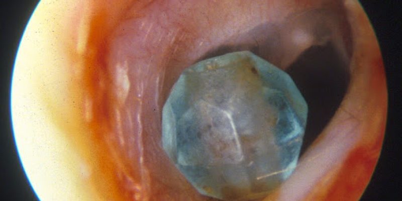 Yogesh Bajaj ENT Consultant